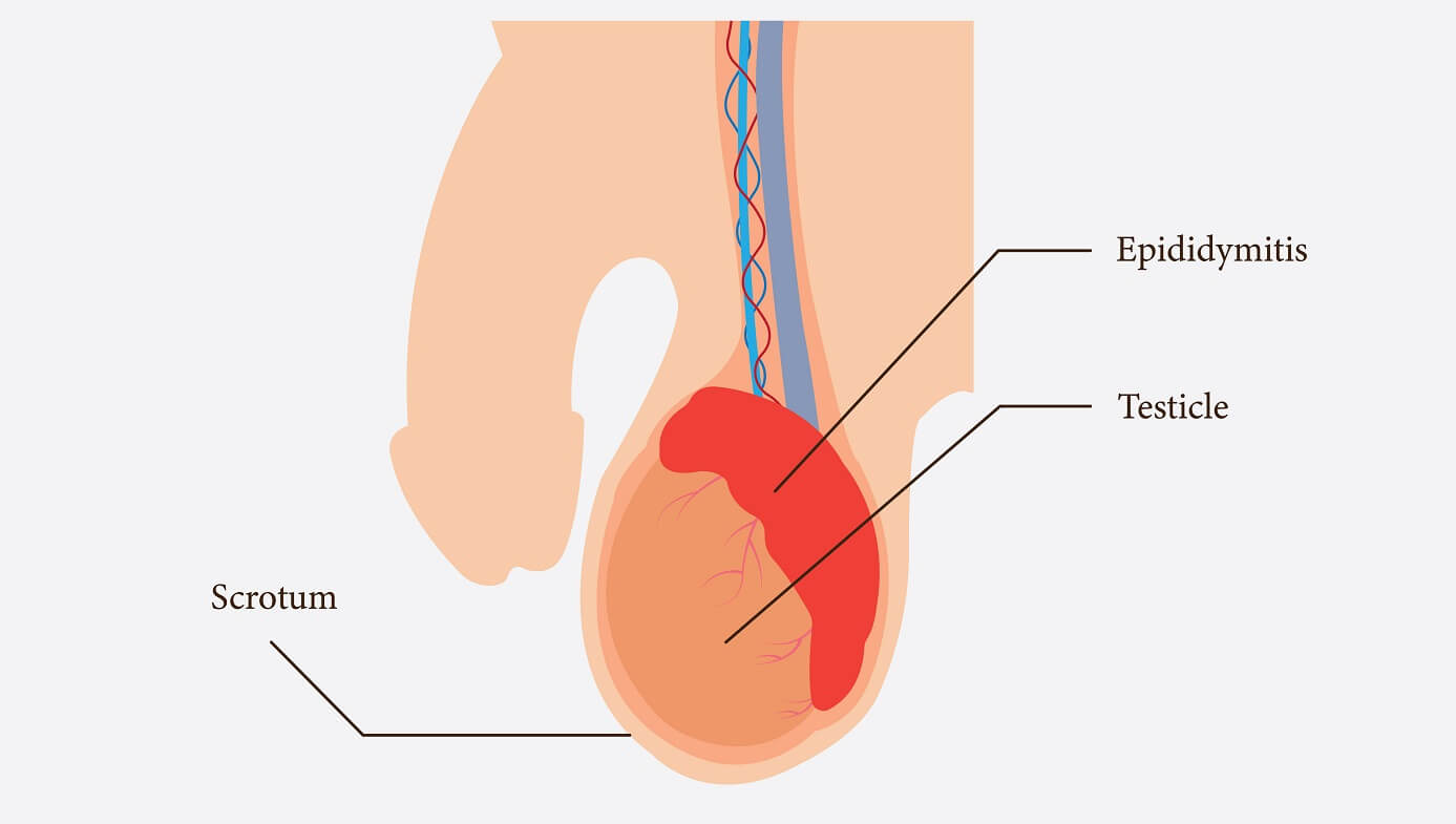 testiculos